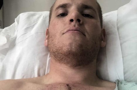 French train hero left with massive scar