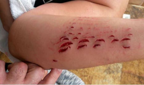 Tourist bitten by shark during Christmas swim off Gran Canaria