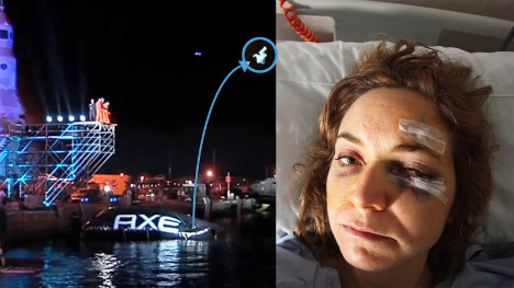 Wannabe astronaut 'blinded' after Ibiza jump goes wrong