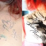 Penis tattoo victim gets cover-up design on back