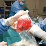 Denmark considers automatic organ donation