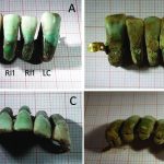Italian archaeologists find ‘world’s oldest dentures’