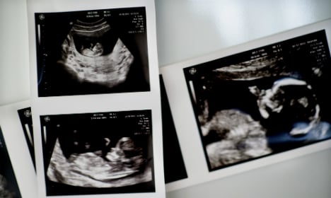 Norway approves pre-natal blood tests to detect Down syndrome