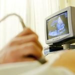 Obesity during pregnancy linked to epilepsy in children: Swedish study