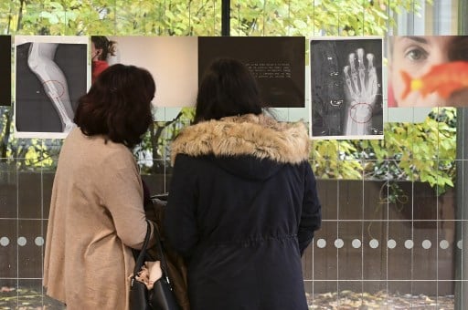 Violence against women: X-rays of broken bones show the scale of Italy's problem