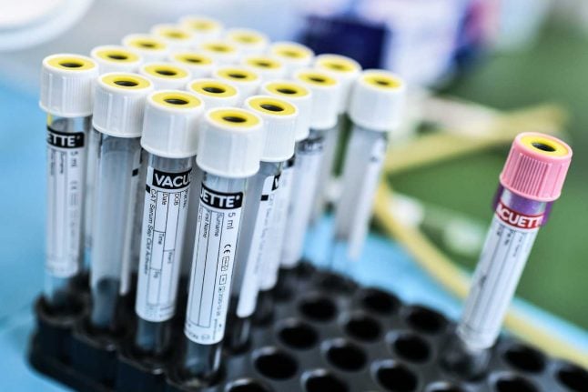 International interest grows in Switzerland’s ‘game-changing’ coronavirus antibody test