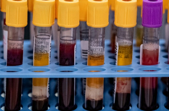 MAP: Where in Sweden can you get an antibody test?