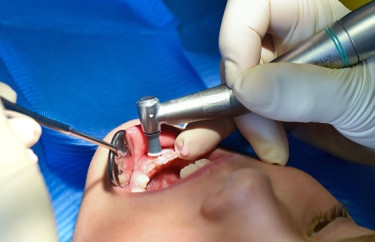 EXPLAINED: How dental care works in Germany