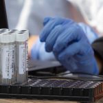 Austrian GPs can now conduct ‘rapid’ coronavirus testing