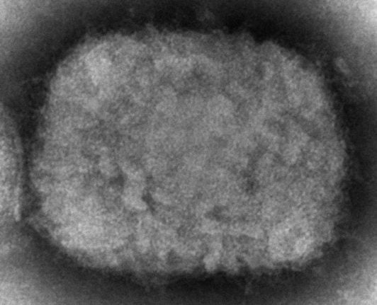 This 2003 electron microscope image made available by the Centre for Disease Control and Prevention shows a monkeypox virion, obtained from a sample associated with the 2003 prairie dog outbreak.