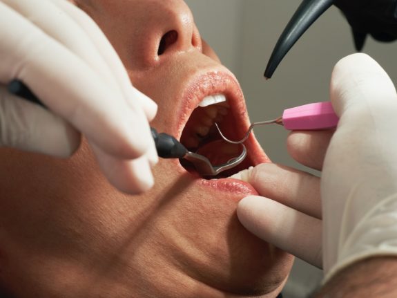 Pictured is dental work being performed.